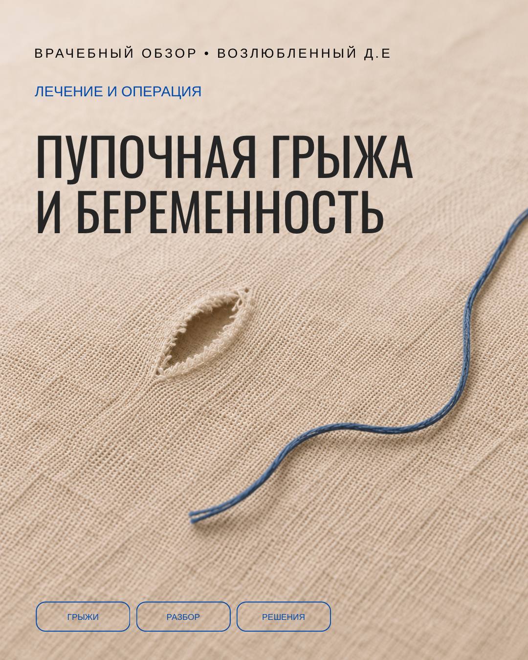 Пупочная грыжа: если впереди беременность