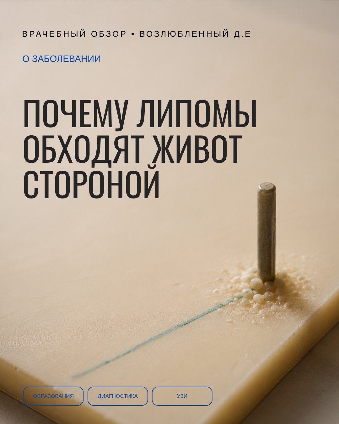 Живот и передняя стенка груди — территория, почти свободная от липом, и это не совпадение