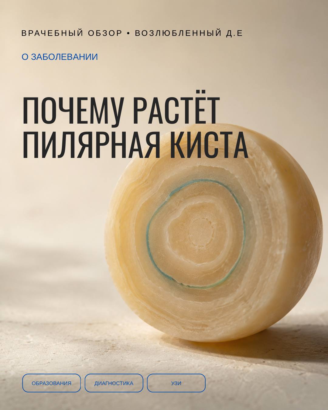 Пилярная киста растёт не просто «от генетики» — метаболический фон тоже управляет её размером