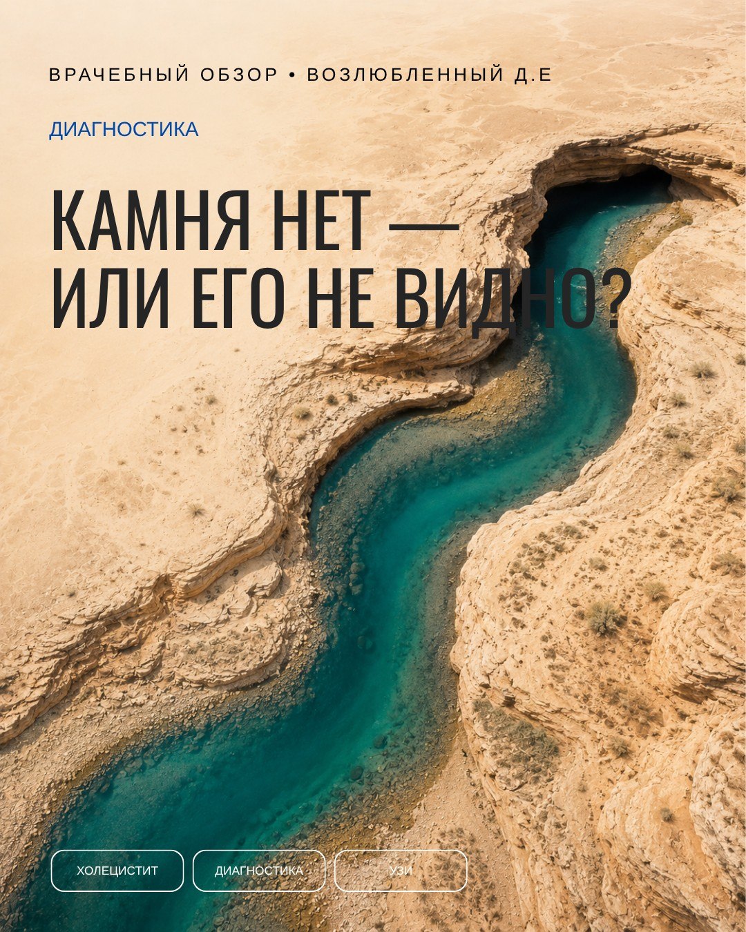 Самый мелкий камень холедоха — тот, что хуже всего виден и чаще всего уходит сам. Отсюда вся дилемма