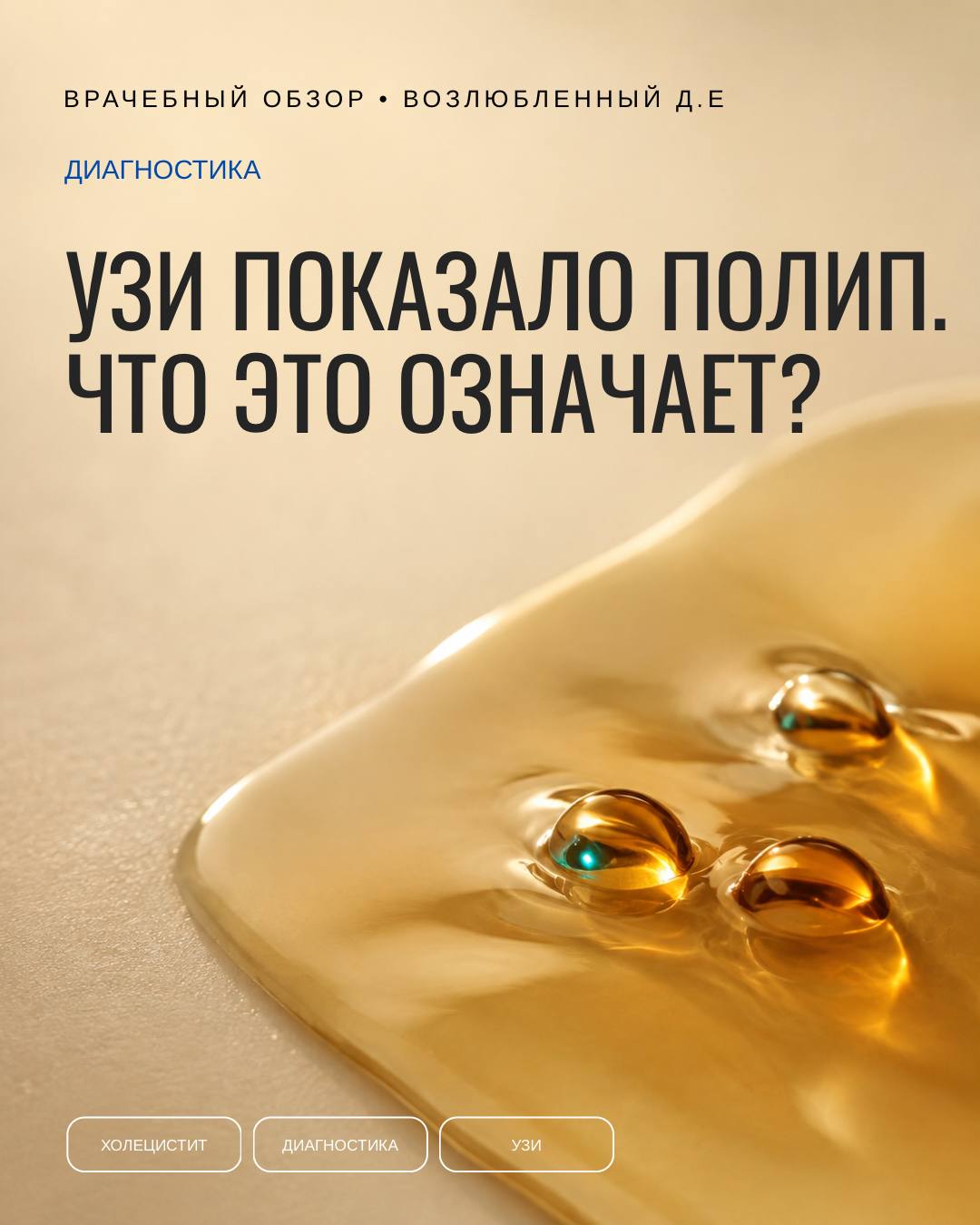 «Полип» на УЗИ — ещё не полип
