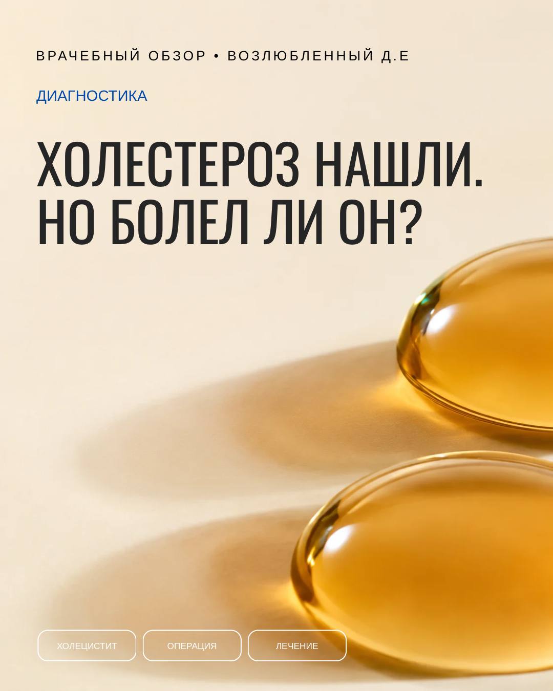 Холестероз: находка не равна причине боли